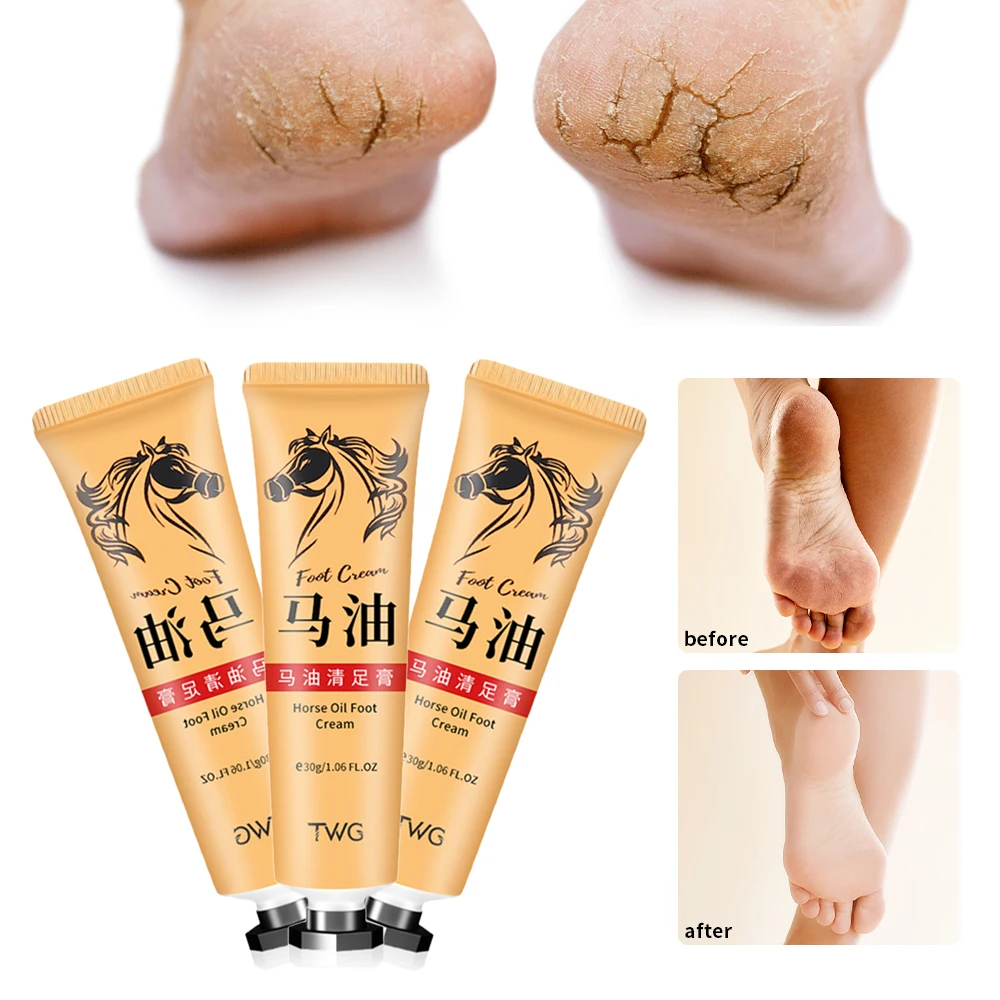 

Horse Oil Repairing Feet Cream Dryness Heel Cracked Foot Moisturizing Ointment Nourishes Removal Dead Skin Callus Hand Feet Care