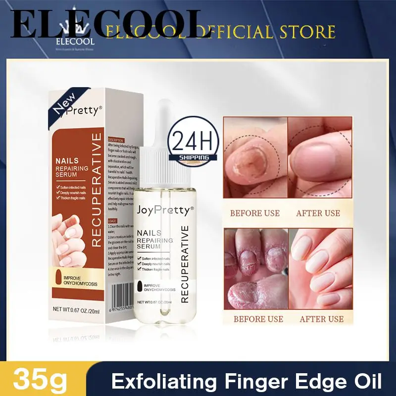 

Лак для ногтей JoyPretty, питательный Блестящий лак для ногтей с защитой от зазубрин, взрывобезопасный мягкий отшелушивающий Искусственный лак для ногтей, средство для ухода за ногтями