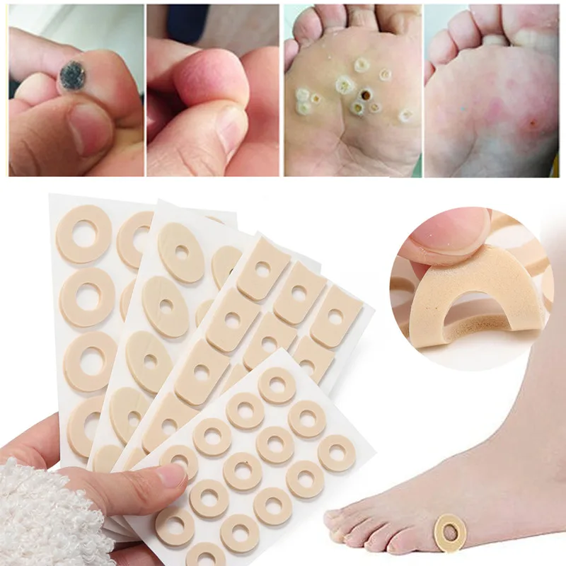 

Healthy Care Relieve Pain Feet Treatment Latex Patch Warts Thorn Remove Plantar Killer Anti-friction High Heel Feet Pads