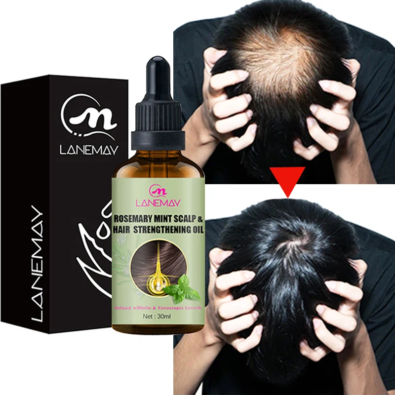 

Hair Grow Essential Oil Hair Regrow Serum Hairline Growth Liquid Hairs Thin Treatment Anti Hair Loss Treat Baldness Scalp Care