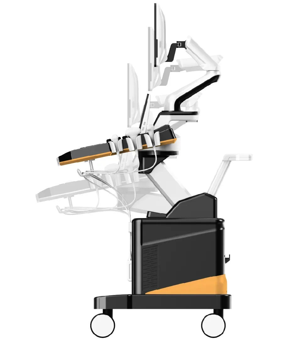 Рисунок 4 - T6-VET Trolley, Цветной Допплер 4D