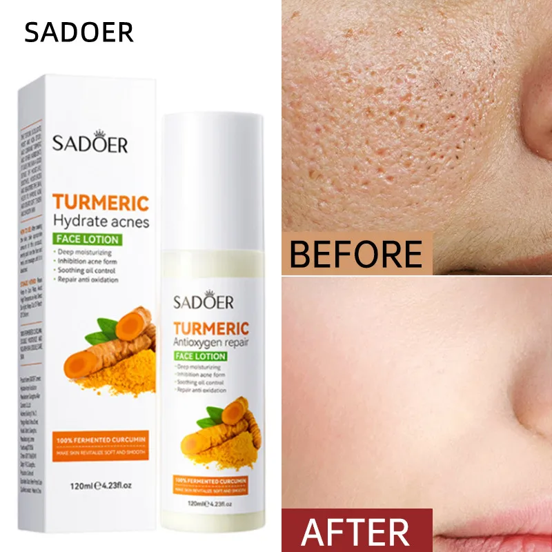 

Тоник для лица с цветами вишни, глубокое увлажнение, контроль жирности, сужение пор, макияж, отбеливание, уход за кожей, тоник японской сакур...