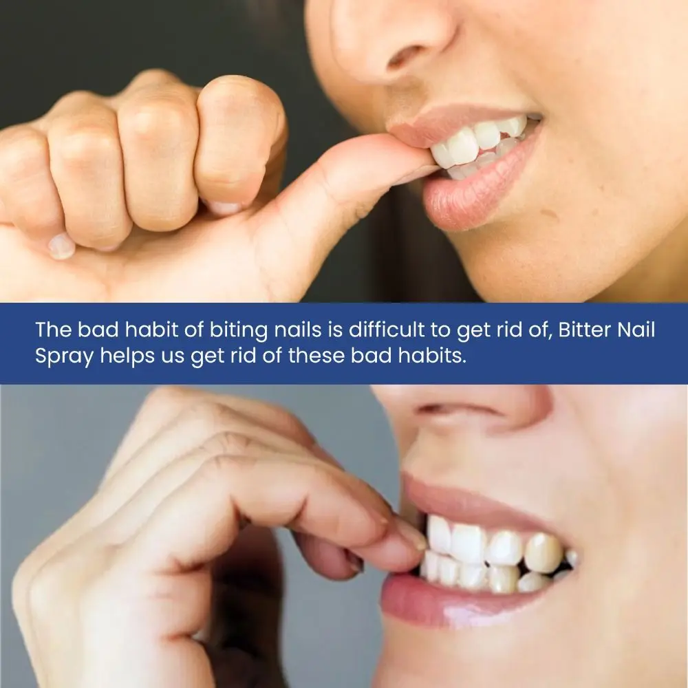 Рисунок 3 - Лак для ногтей эффективный против