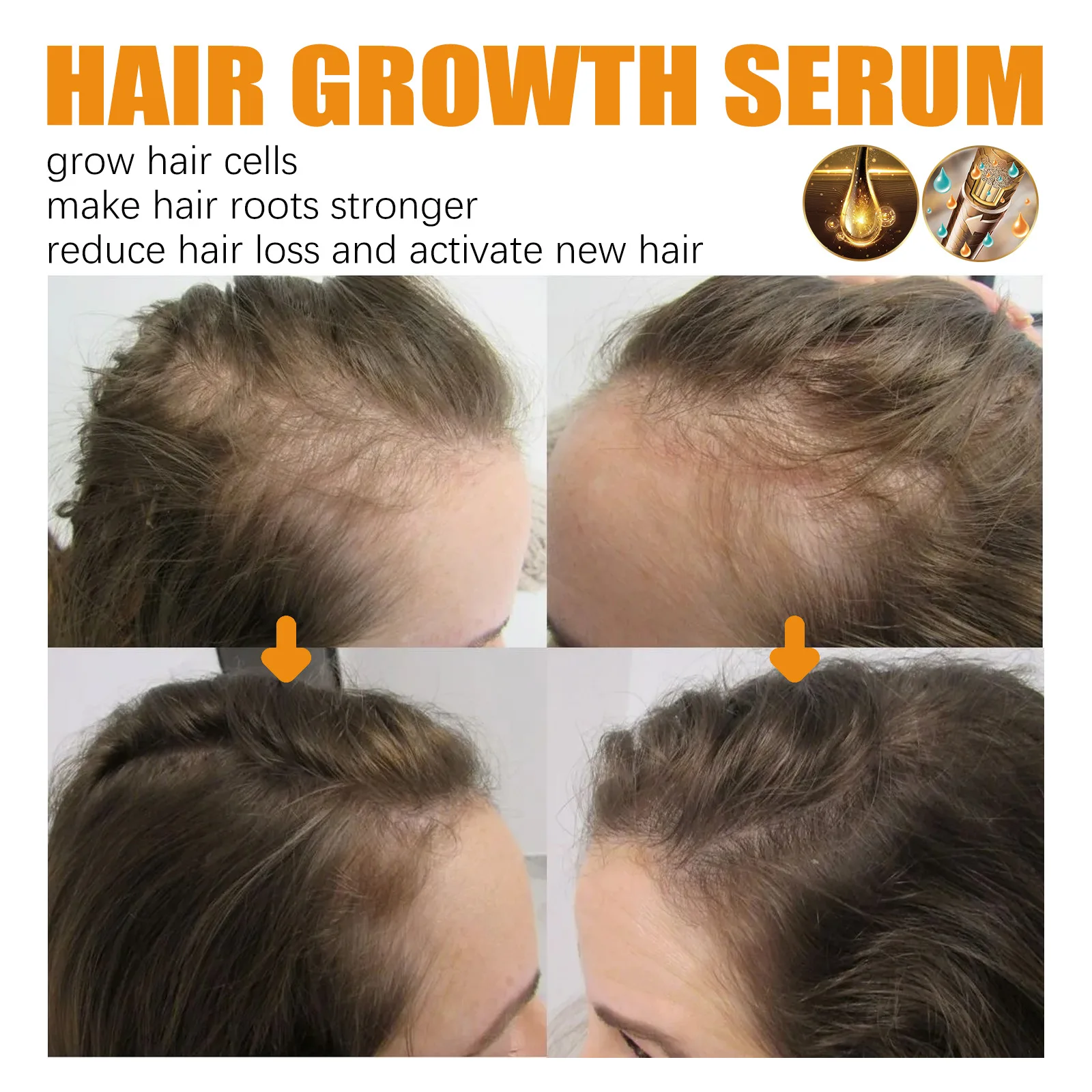 Anti Alopecia Fast Hair Growth Oil Essential Oils Essence Anti Loss Bald Treatment Scalp Massage Serum Hair Thickening images - 6
