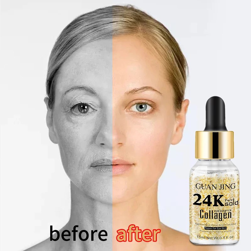 

30 Days takes 10 years off! Anti-aging and Anti-Wrinkle Eye Cream Eye Repair Serum Retinol Corrected Eye Cream for Dark Circles