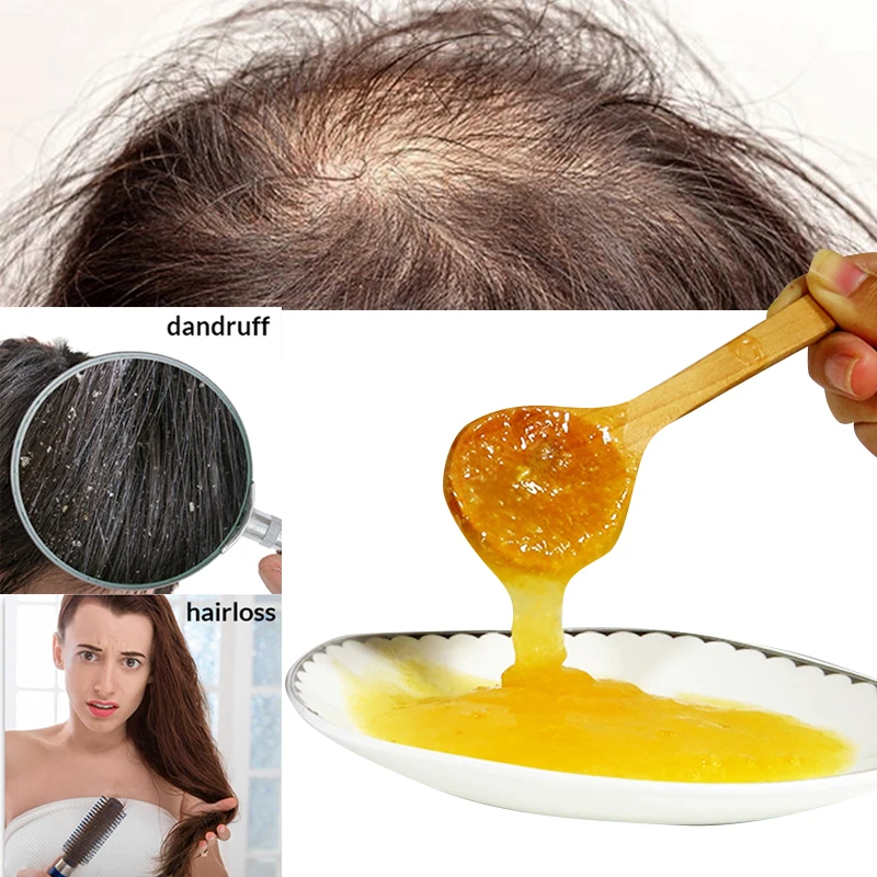 250g Ginger Anti Hair Loss Shampoo promote hair growth Shampoo Hair Thick Fast Growth Serum Herbal Liquid free shipping