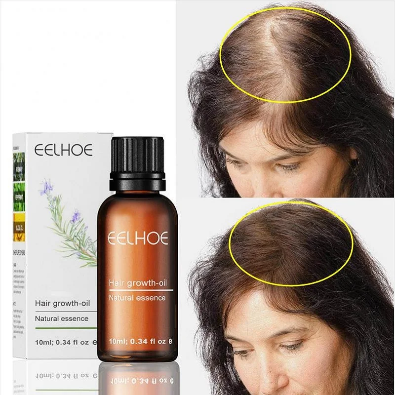 

Eelhoe Rapid Regeneration Anti-Hair Loss Rosemary Hair Growth Oil Hair Regeneration Repair Damaged Hair Care Deep Treatment Oil