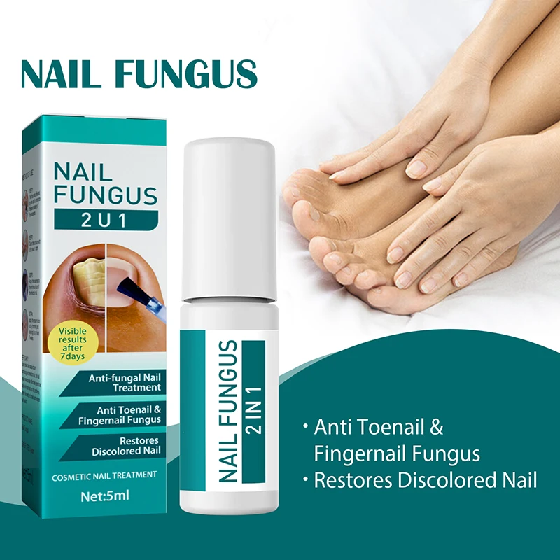 

1 Набор 5 мл лечение инфекции ногтей на пальцах для ногтей противогрибковое восстановление поврежденных ногтей Лечение грибка лечение эссе...