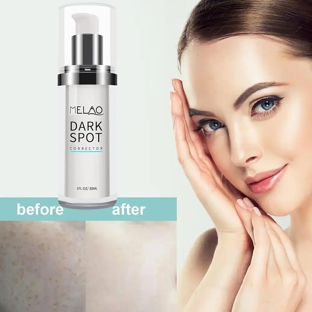 

Face Correcting Brightening Serum Glow Removing Pale For Dark Spot Corrector Whitening Brightening Essence 30ML