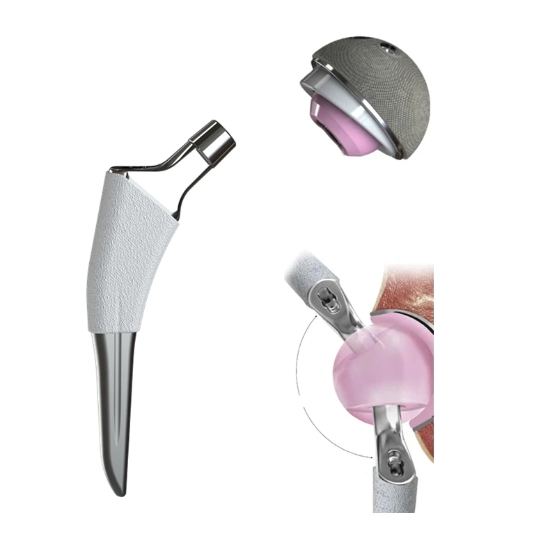 

Titanium hip prosthesis femoral stem with double coating prosthetic component
