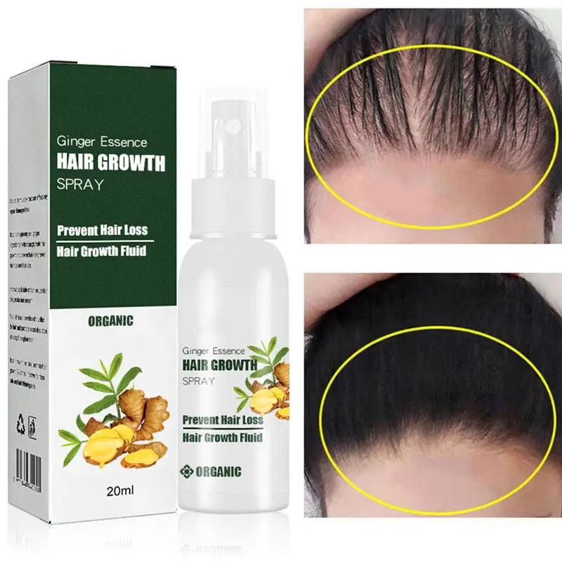 

Ginseng Hair Regeneration Spray 20ml Ginger Essence Hair Loss Essence Moisturizing Natural Growth Strength Thickness Length