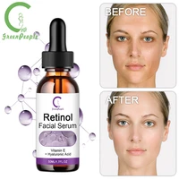 gpgp greenpeople anti aging vitamina retinol facial serum resists greasy exfoliating chicken skin whitening skin care serum