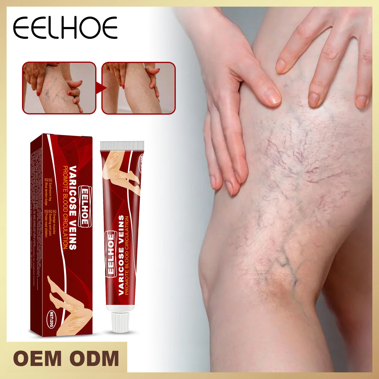 

EELHOE Massage Cream Varicose Veins Relieve Leg Blood Vessel Bulge Calf Swelling Earthworm Leg Veins Improve Body Massage Cream