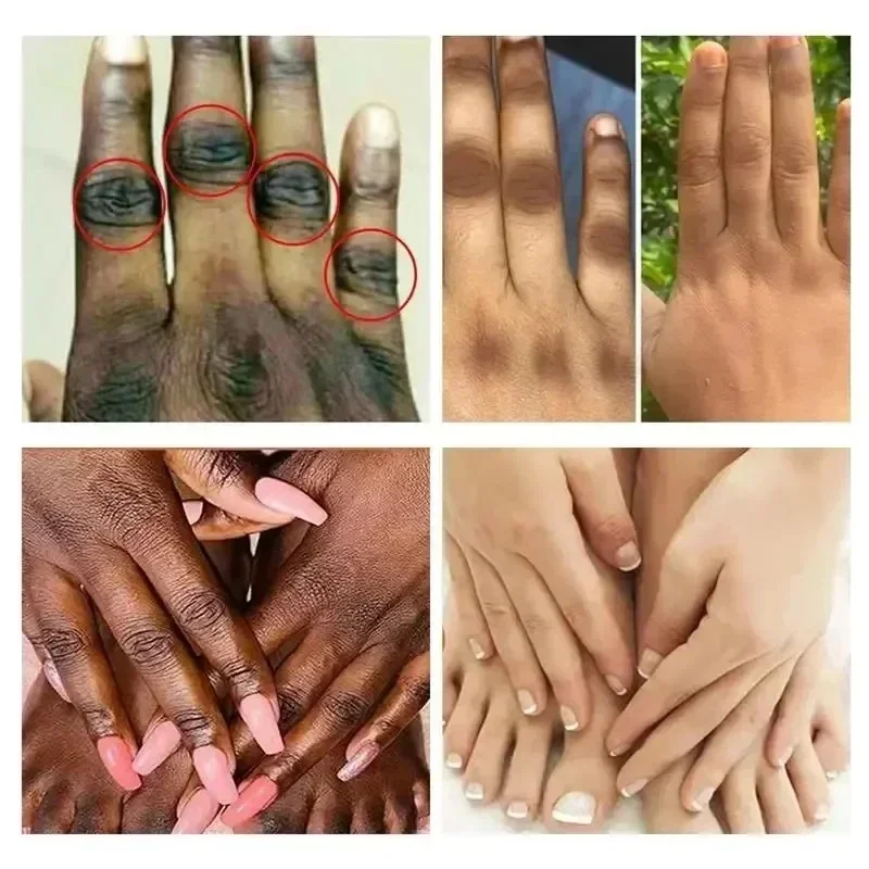 Увлажняющий крем для красоты тела отбеливающий быстрого отбеливания частных