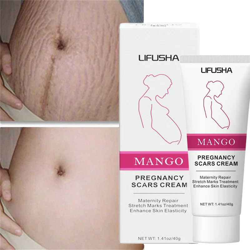 

Stretch Marks Remover Cream Removes Postpartum Pregnant Women Scar Repair Obesity Stretch Mark Whiten Moisturize Body Care Cream