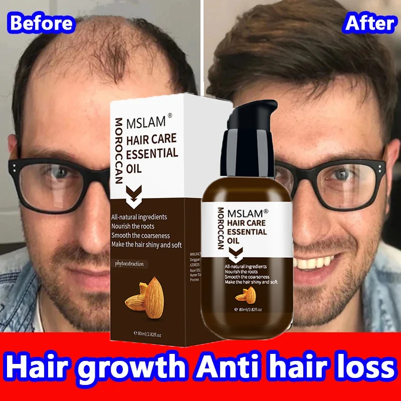 Fast Hair Growth Essence Oil Effective Treatment For Baldness Prevent Thinning Repair Damage Nourish Hair Roots Care Serum 80ML