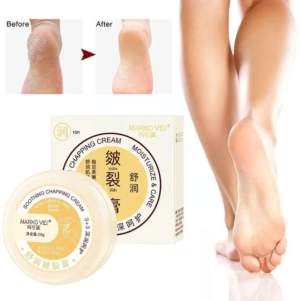 

20g Anti-Drying Crack Foot Cream Heel Cracked Repair Care Hand Dead Feet Cream Skin Removal U7C8