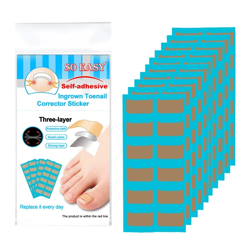 

120Pcs/Set Ingrown Toenail Tool Ingrown Toenail Correction Stickers Professional Pedicure Tools For Repairing Paronychia