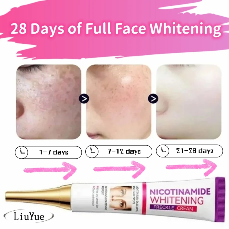 Крем для быстрого удаления мелазмы Осветляющий и крем кожи никотинамидная