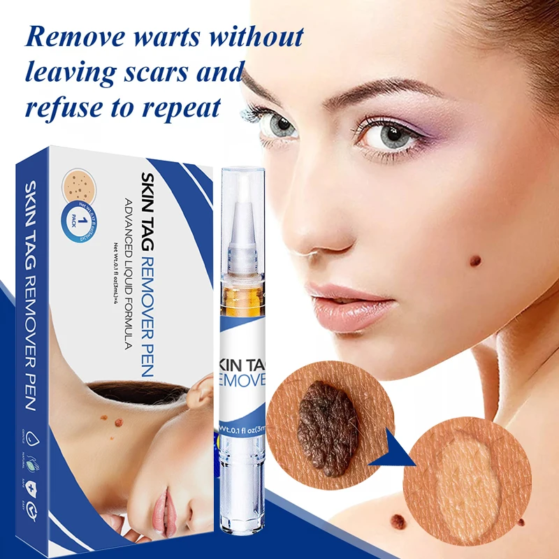 

Skin Tag Remover Cream Clean Painless Mole Skin Dark Spot Warts Remover Serum Freckle Face Wart Tag Treatment Essential Oil