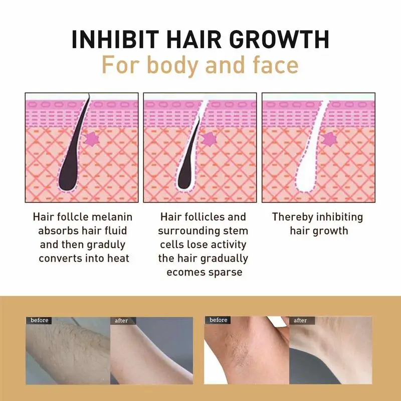 Рисунок 5 - Женский спрей для удаления волос