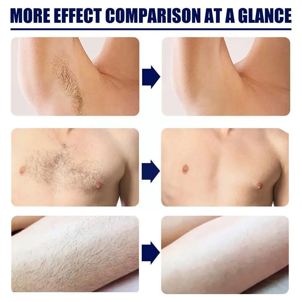 

Men's Hair Removal Cream Mild Not Atimulate Safetyharmless Depilation Body Painless Armpit N4u7