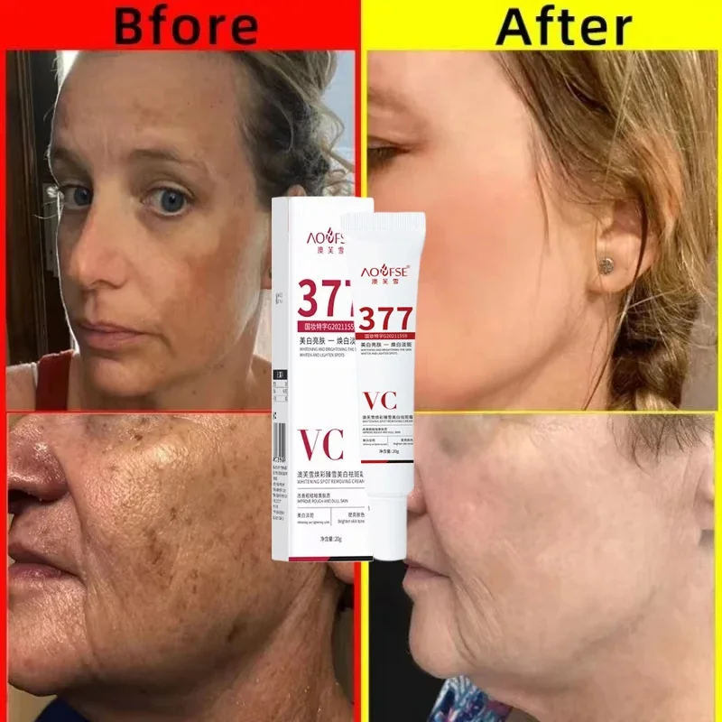 Niacinamide мелазма Осветляющий крем уменьшает меланин осветляет темную кожу хлоазма