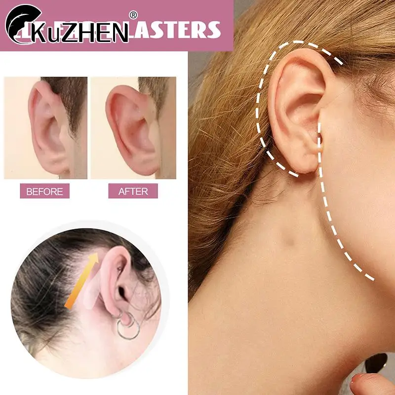 

30PCS Elf Ear Stickers Veneer Ears Become Ear Correction Vertical Stand Ear Stickers V-Face Photo Stereotypes