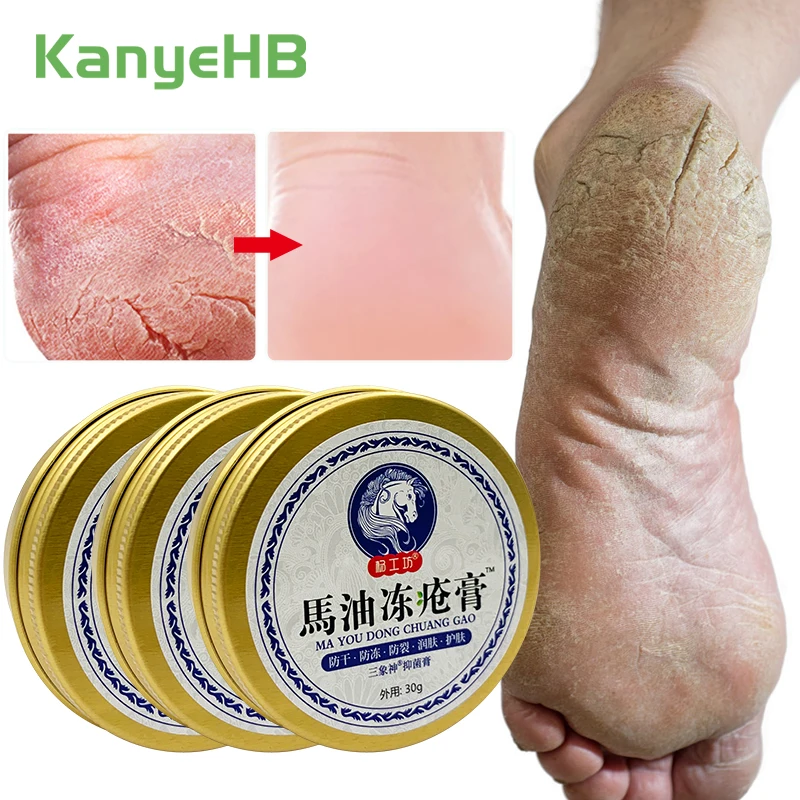

3Pcs Anti-Drying Crack Foot Cream Chinese Herbal Cream Heel Cracked Repair Cream Removal Dead Skin Feet Care Oil For Family A920