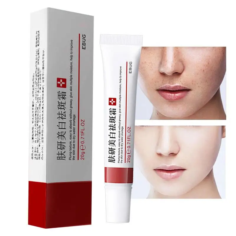 

Dark Spots Corrector Corrector For Body Dark Spots Corrector Remover With Alphas Arbutins Niacinamide Vitamin E 20g Dark Spots