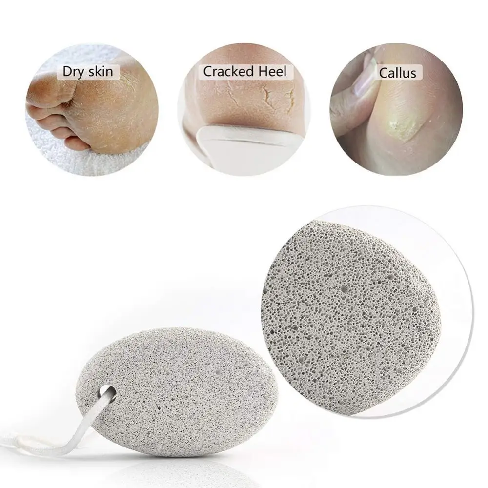 Hot Sale Oval Pumice Stone Foot Grinder Death Hard Skin Callus Remover Feet Pedicure Tool | Care