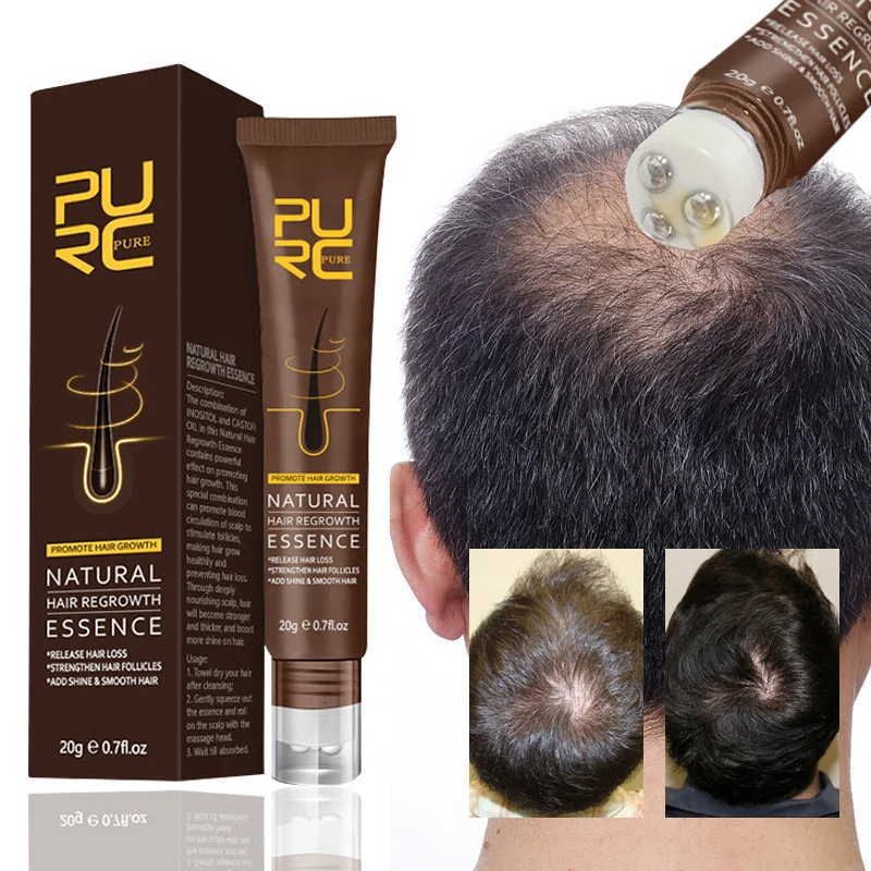 Fast Hair Growth Serum Anti Hairs Loss Care Thickening Prevent Hair Scalp Massage Oil Treatments Damaged Hair Repair Essence