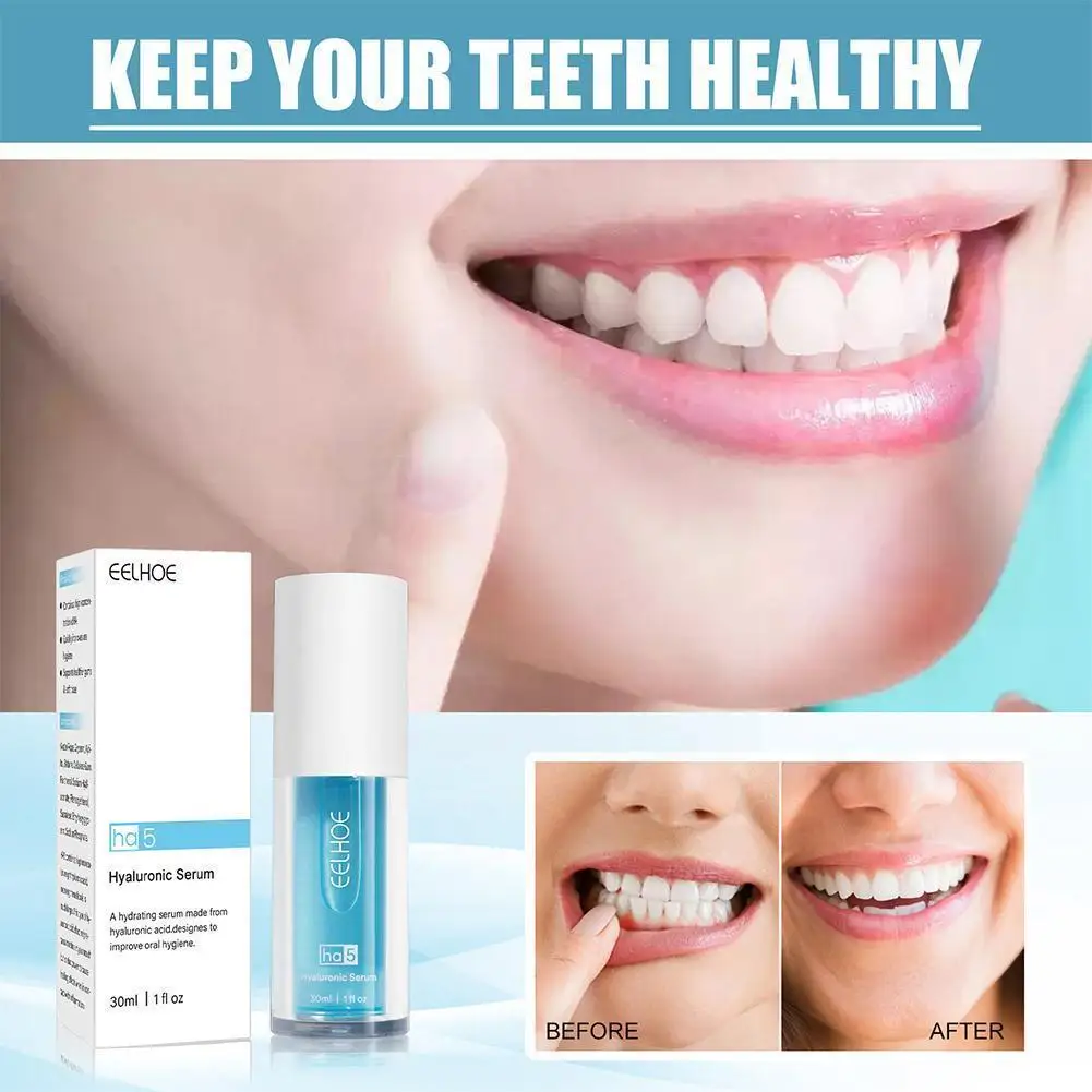 

30ml Hyaluronic Acid Serum Toothpaste Stain Removal Teeth Bleeding Fight Gums Care Breath Whitening Toothpaste D8x2
