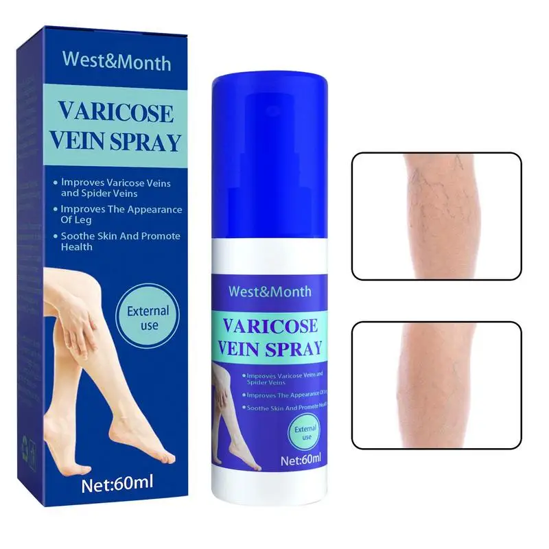 

Спрей от варикозного расширения вен, 60 мл