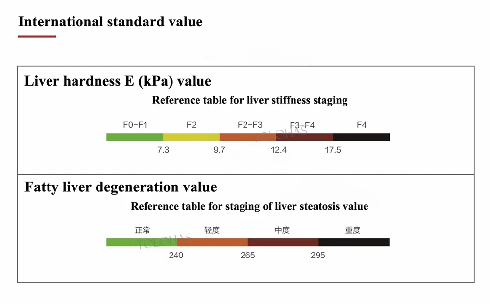 LHAULS Ультразвуковое устройство для эластиграфии HBV неинвазивный детектор
