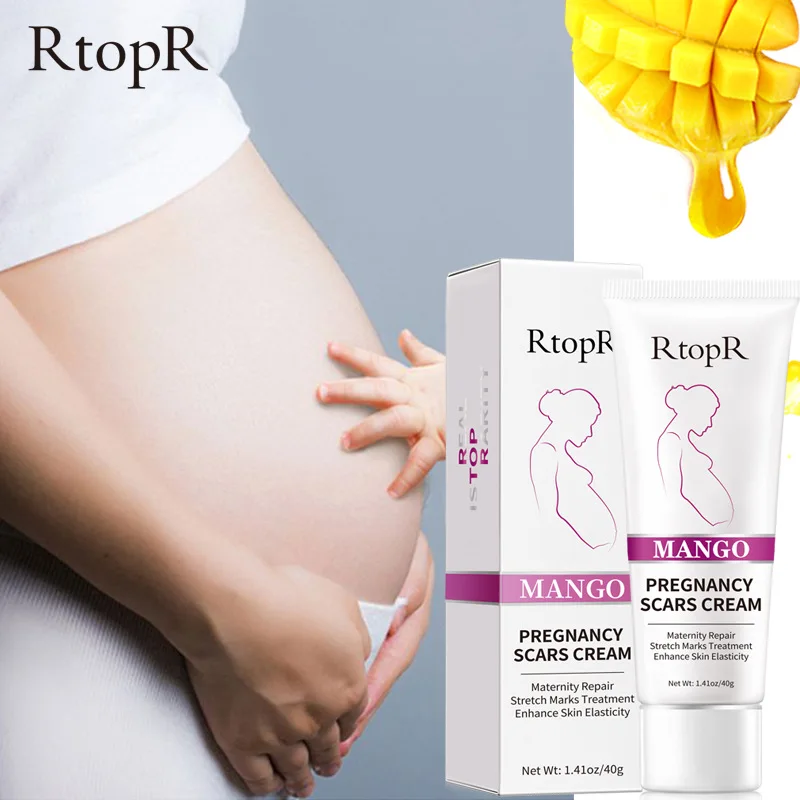 

Манго RtopR, для Удаления растяжек