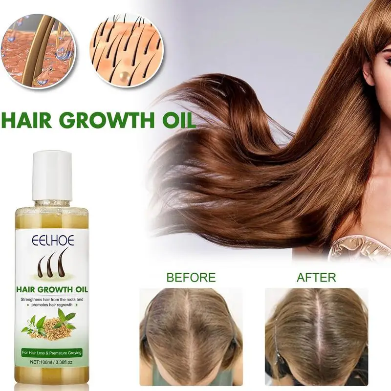 

Кокосовое масло для роста волос, 100 мл, Маргаритка, органическое масло для укрепления кожи головы и волос, питательное эфирное масло для роста волос для женщин