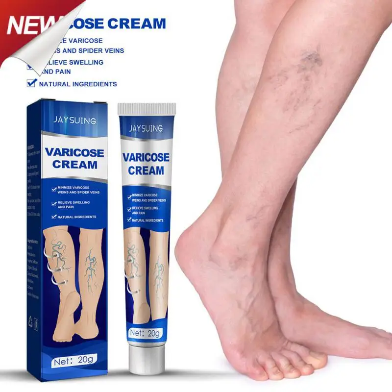 

20g Varicose Veins Spray Varicosity Repair Cream Varicocele Remove Relief Pain Phlebitis Legs Varicose Veins Skin Care