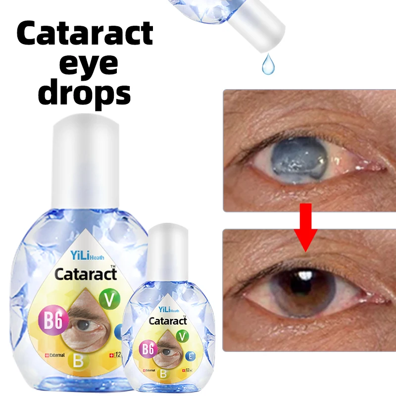 12 мл капли для ухода за коарактом лечения размытого зрения с витамином B6 и