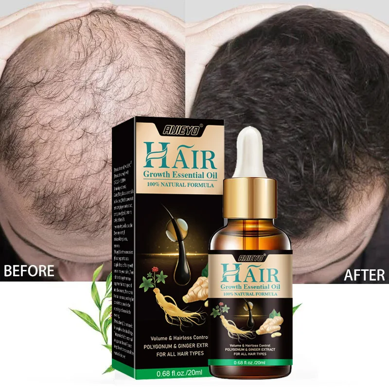 Fast Ginger Growth Serum Anti Hair Loss Essential Oils Prevent Baldness Thinning Dry Scalp Treatment Products Beauty Hair Care