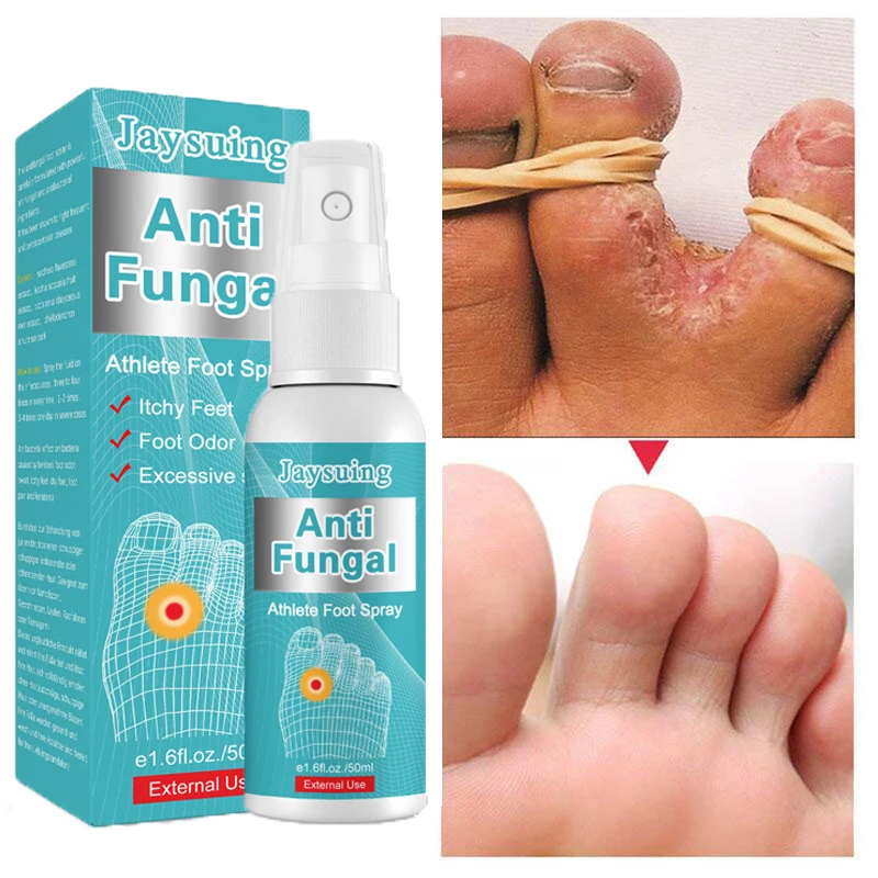 

50ML Athlete's Foot Spray Herbal Antifungal Itching Relieve Beriberi Foot Eczema Onychomycosis Treatment Infection Repair Care