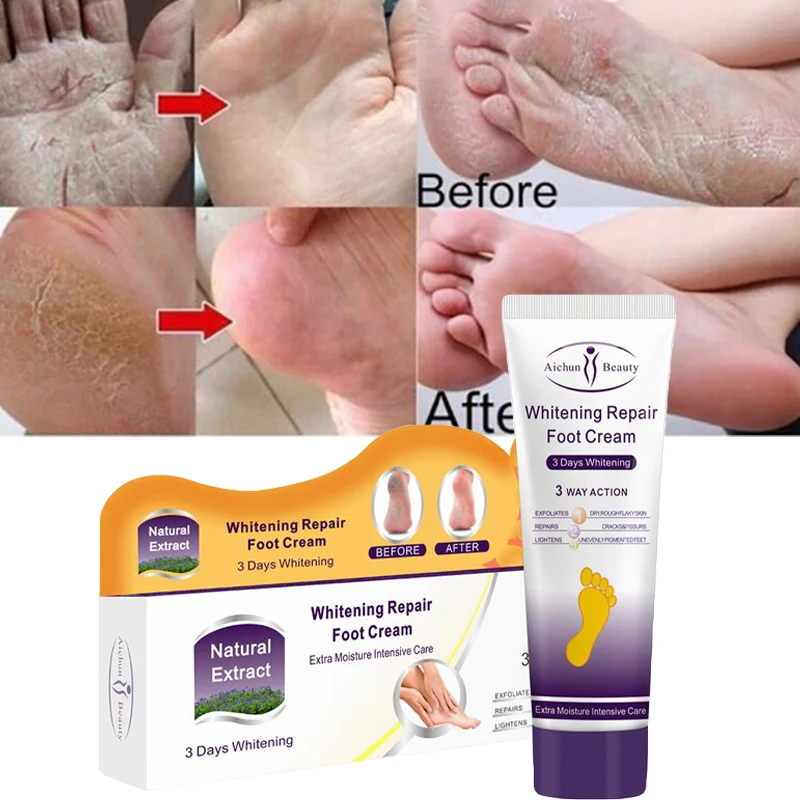 

Эффективный противогрибковый крем против трещин лечение треснувший увлажняющий продукт пилинг ремонт поврежденной кожи уход за кожей ног ...