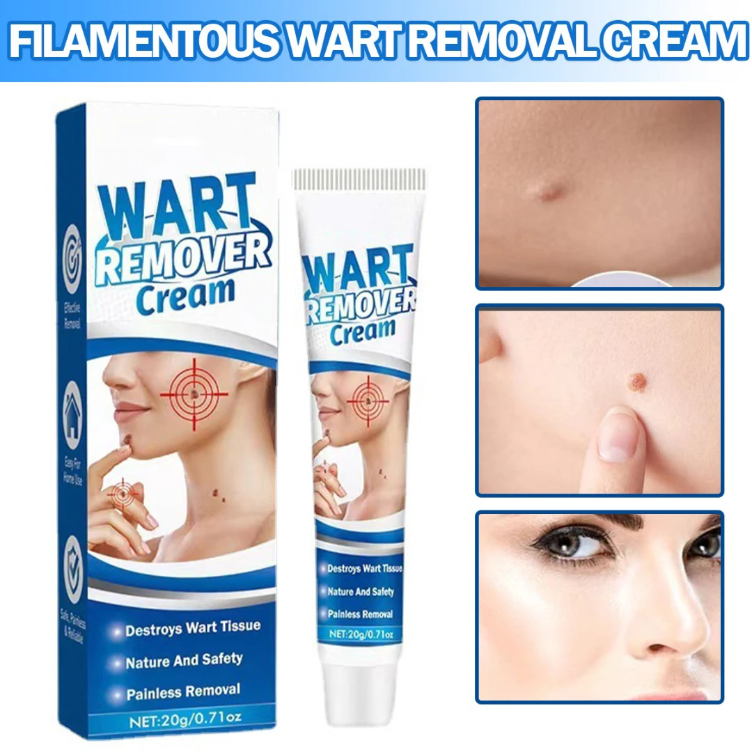 

1 Pc Wart Remover Cream Skin Tag Removal Herbal Extract Ointment Treatment Body Foot Corn Warts Ointment for Women Men Beauty