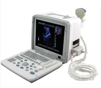 cheapest price laptop digital black and white portable ultrasound machine