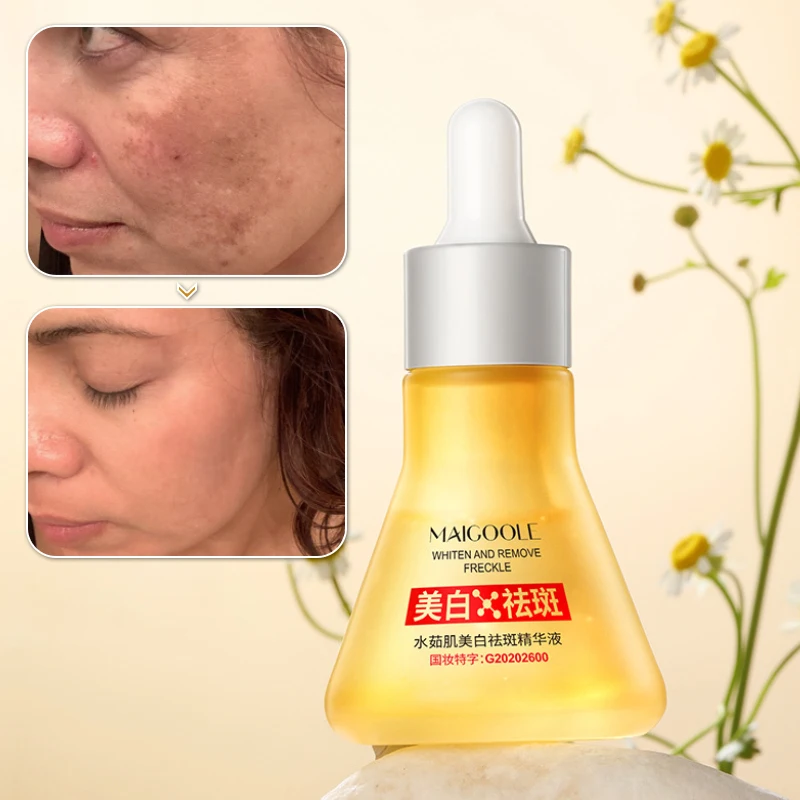 

Face Serum Remove Dark Spots Melasma Freckle Whitening Moisturizing Anti-Aging Fade Pigmentation Brightening Skin Face Care 30ml