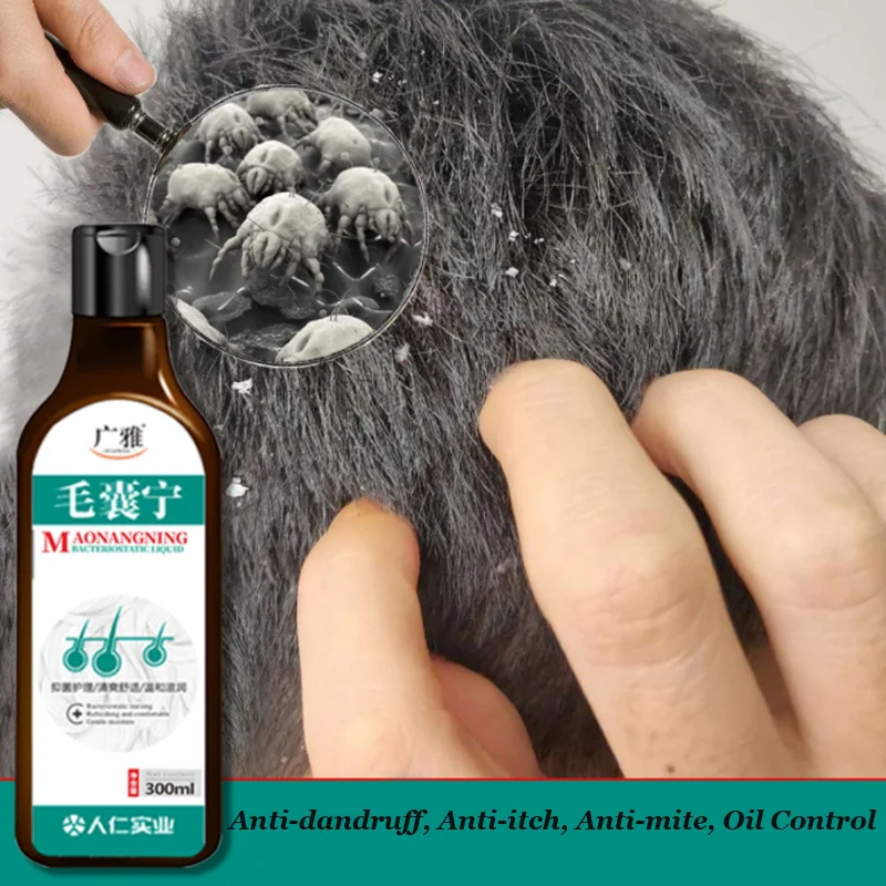 

Natural Plant Mites Shampoo Anti-dandruff Anti-itching Shampoo Scalp Treatment Dermatitis Eczema Herbal Shampoo Hair Care
