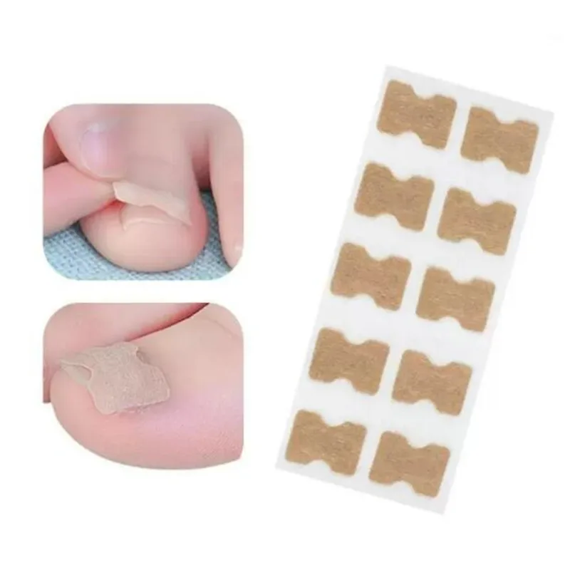 20/60 шт. пластыри для коррекции вросших ногтей | Красота и здоровье
