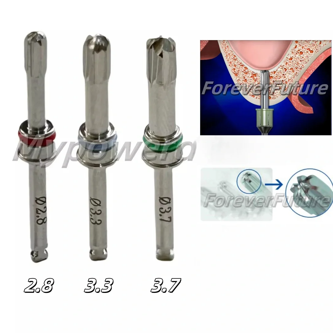 Стоматологическая пазуха настенная развертка дрель мембранный подъемник сверла