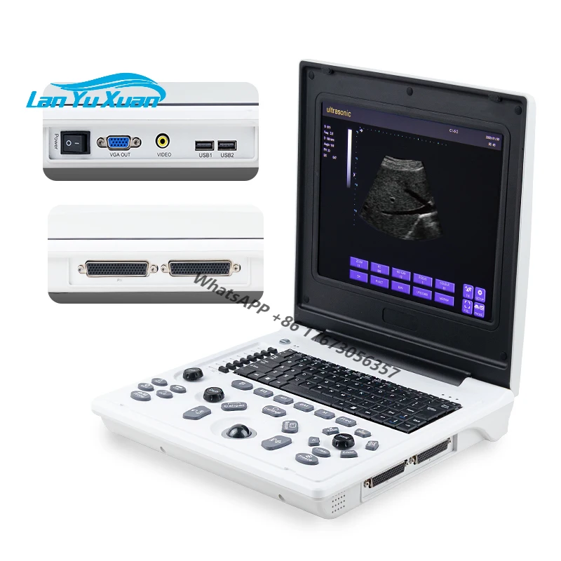 

portable ultrasound laptop ultrasound portable probe ultrasound machine equipments