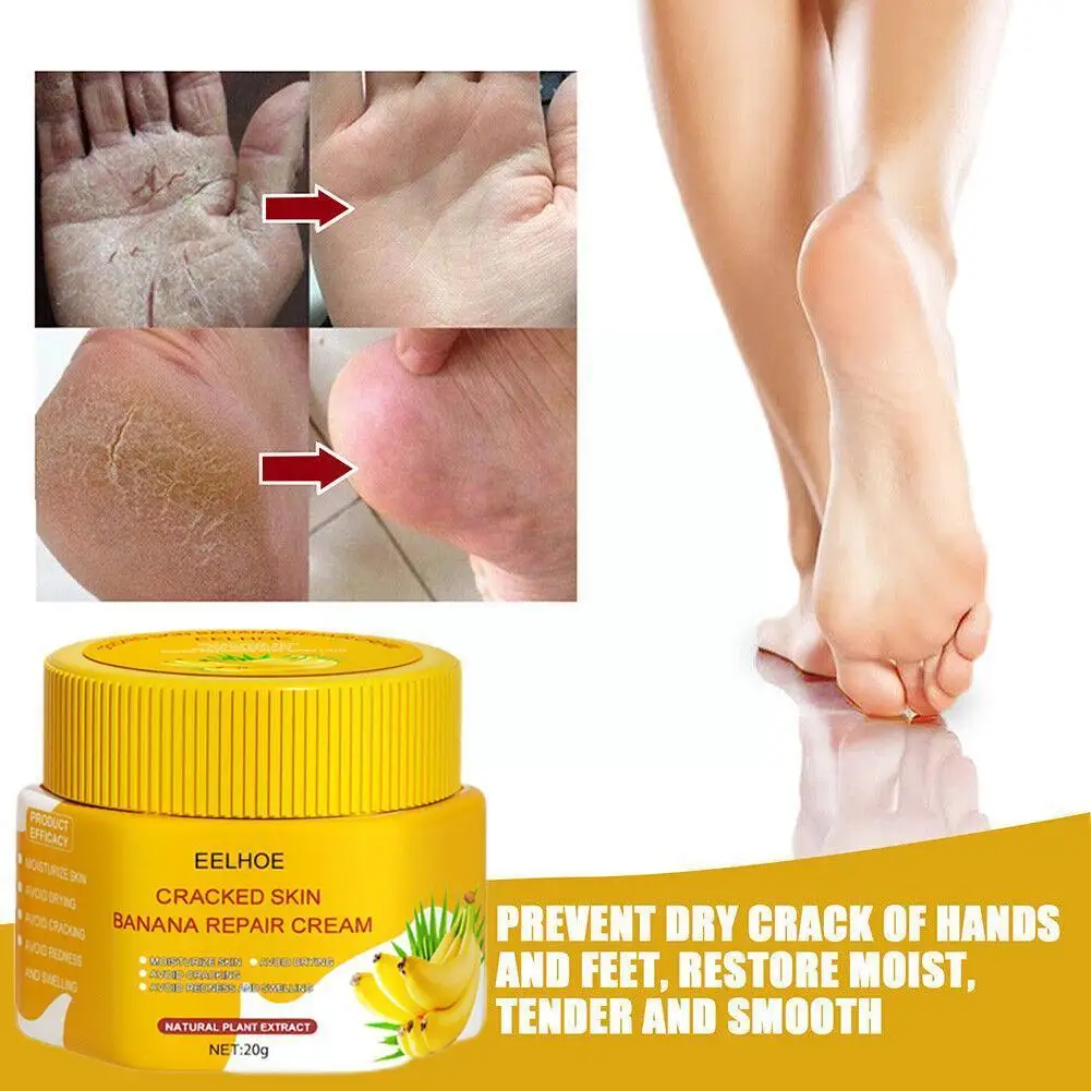 

Natural Banana Oil Moisturizing Cracked Heel Balm Foot Skin Removal Hand Dead Skin Anti-Drying Repair Ointment Smooth Cream Y6D9